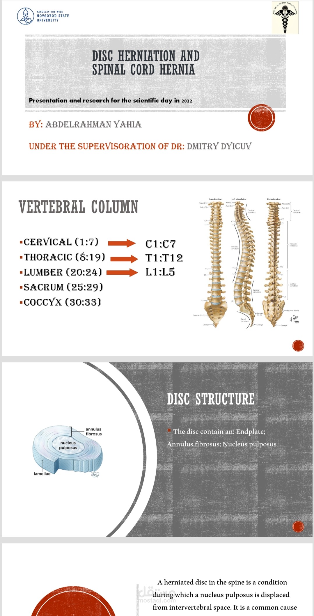 Disk herniation and spinal cord hernia
