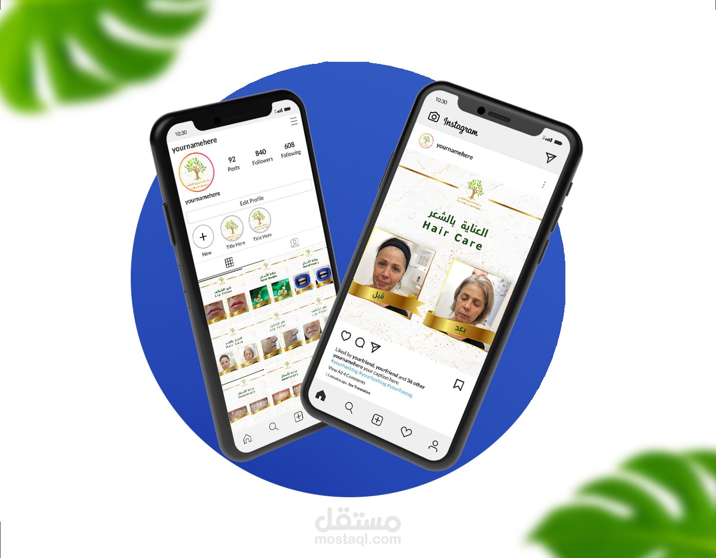 before & after design