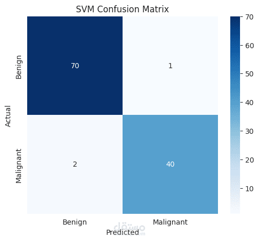 اكتشاف سرطان الثدي باستخدام تقنيات التعلم العميق