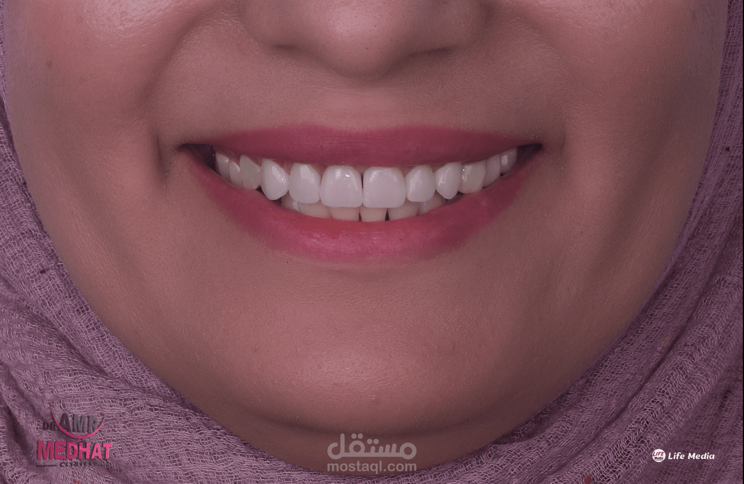 فيديو موشن جرافيك لدكتور اسنان