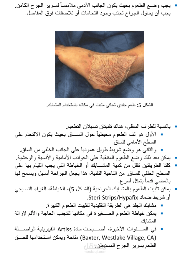 من مقال طبي تخصصي حول الجراحة التجميلية للحروق
