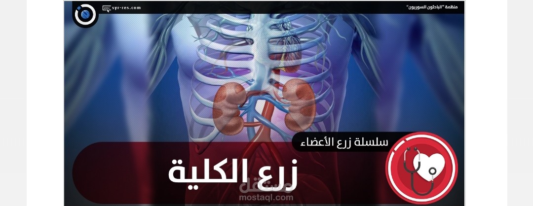 إعداد مقال عن زرع الكلية