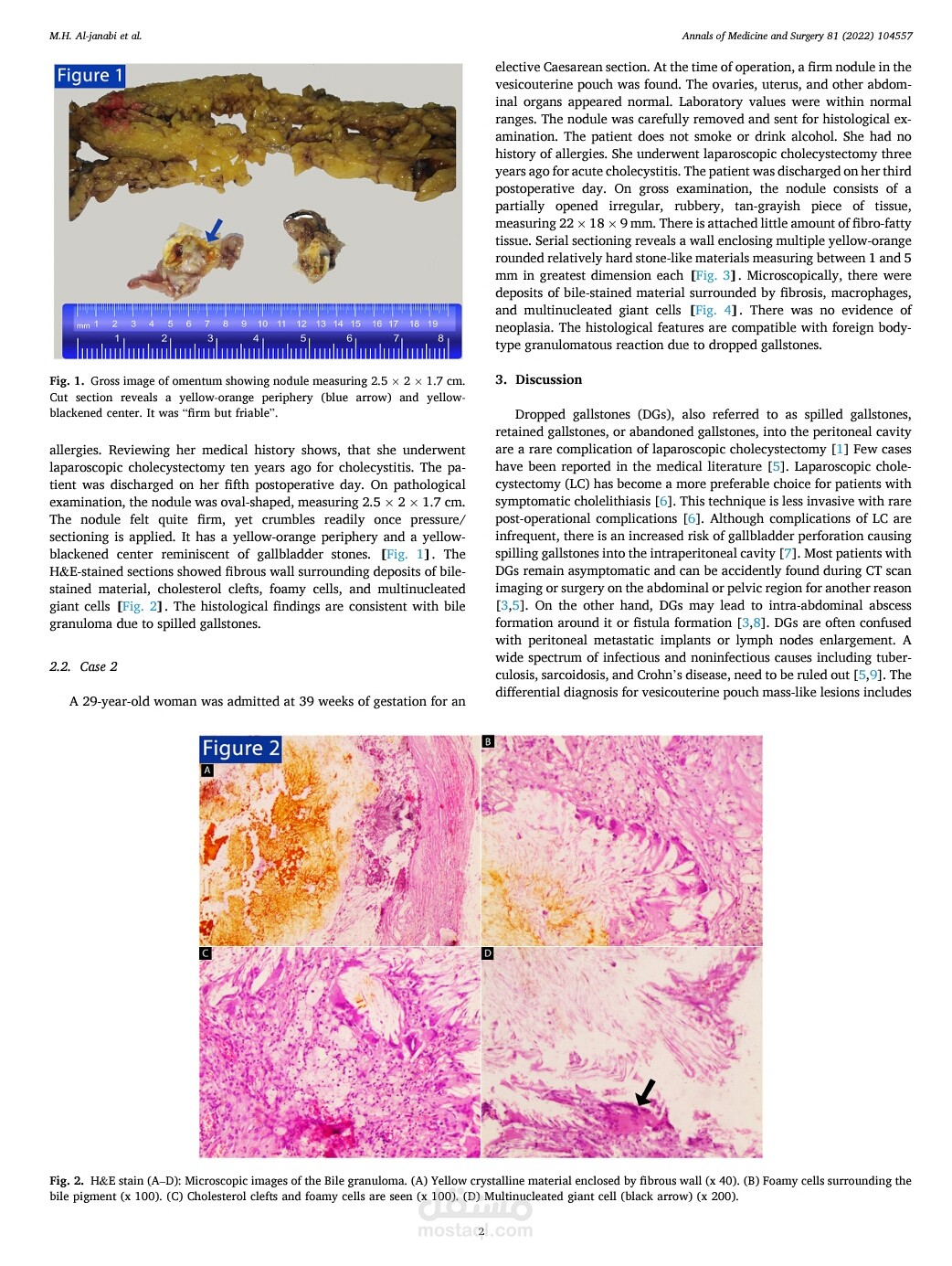 Case report