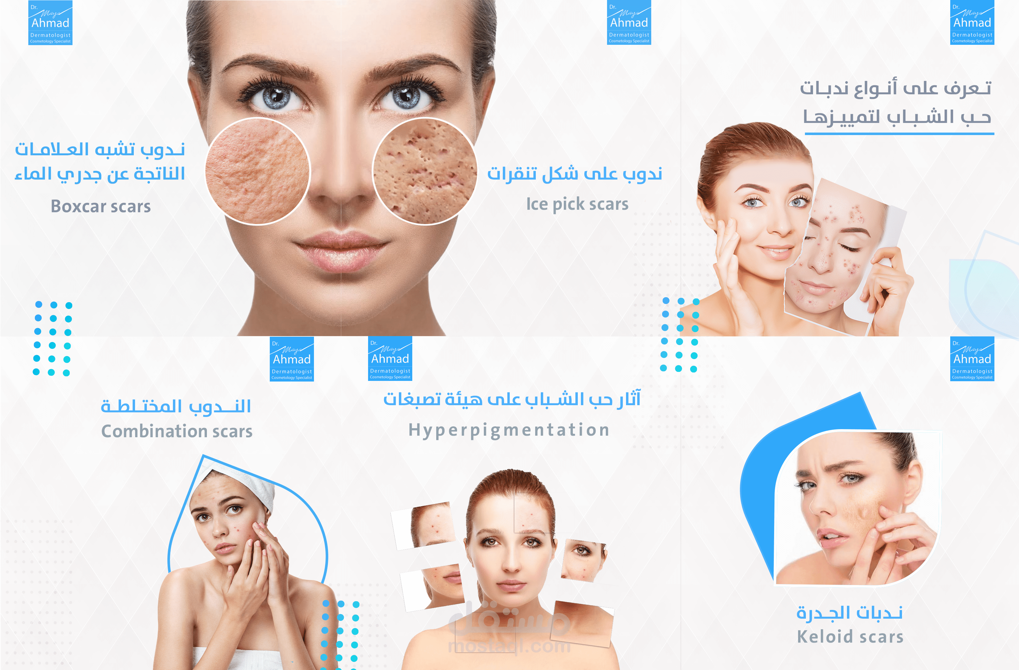 أنواع الندبات