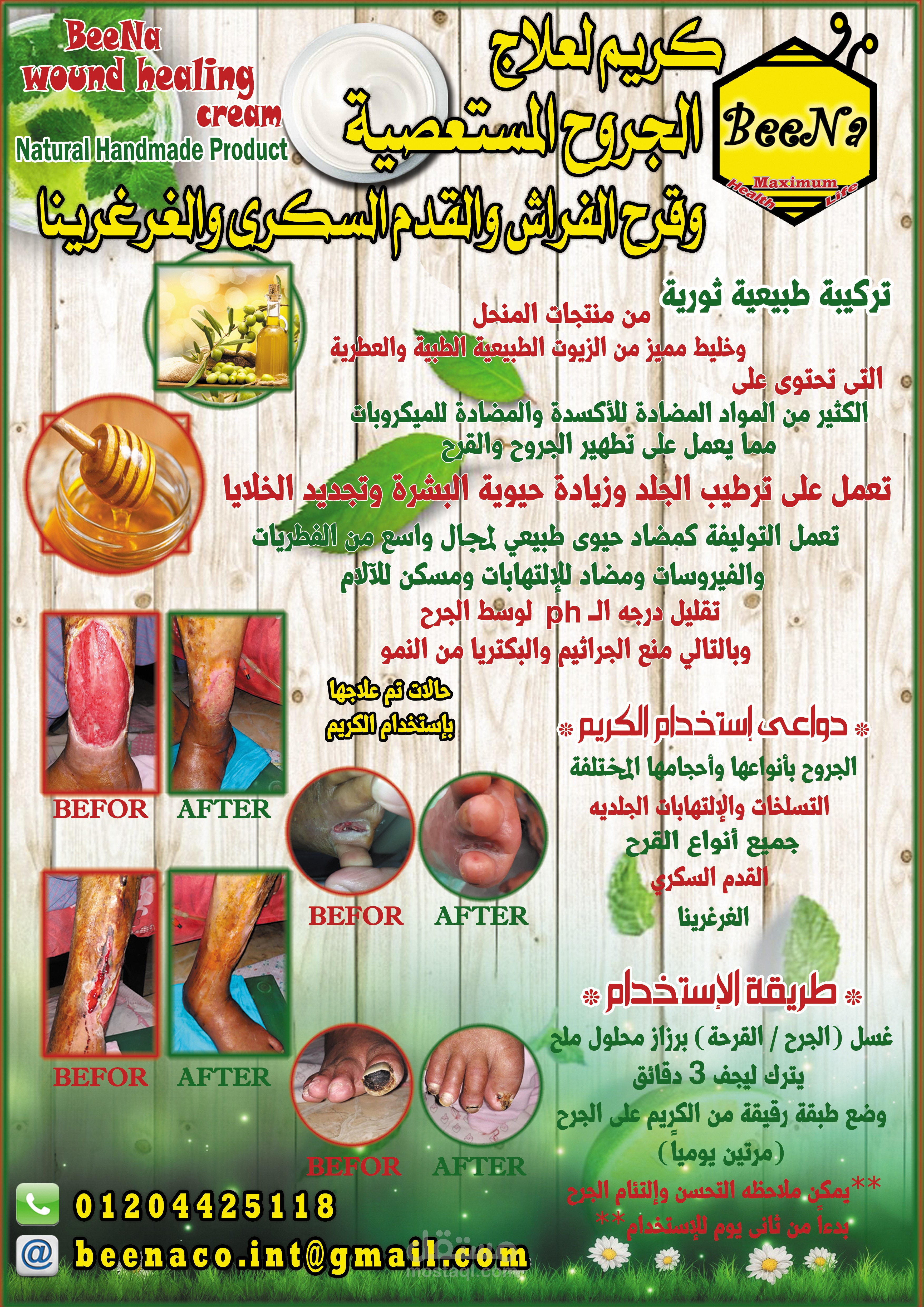 فلاير 2