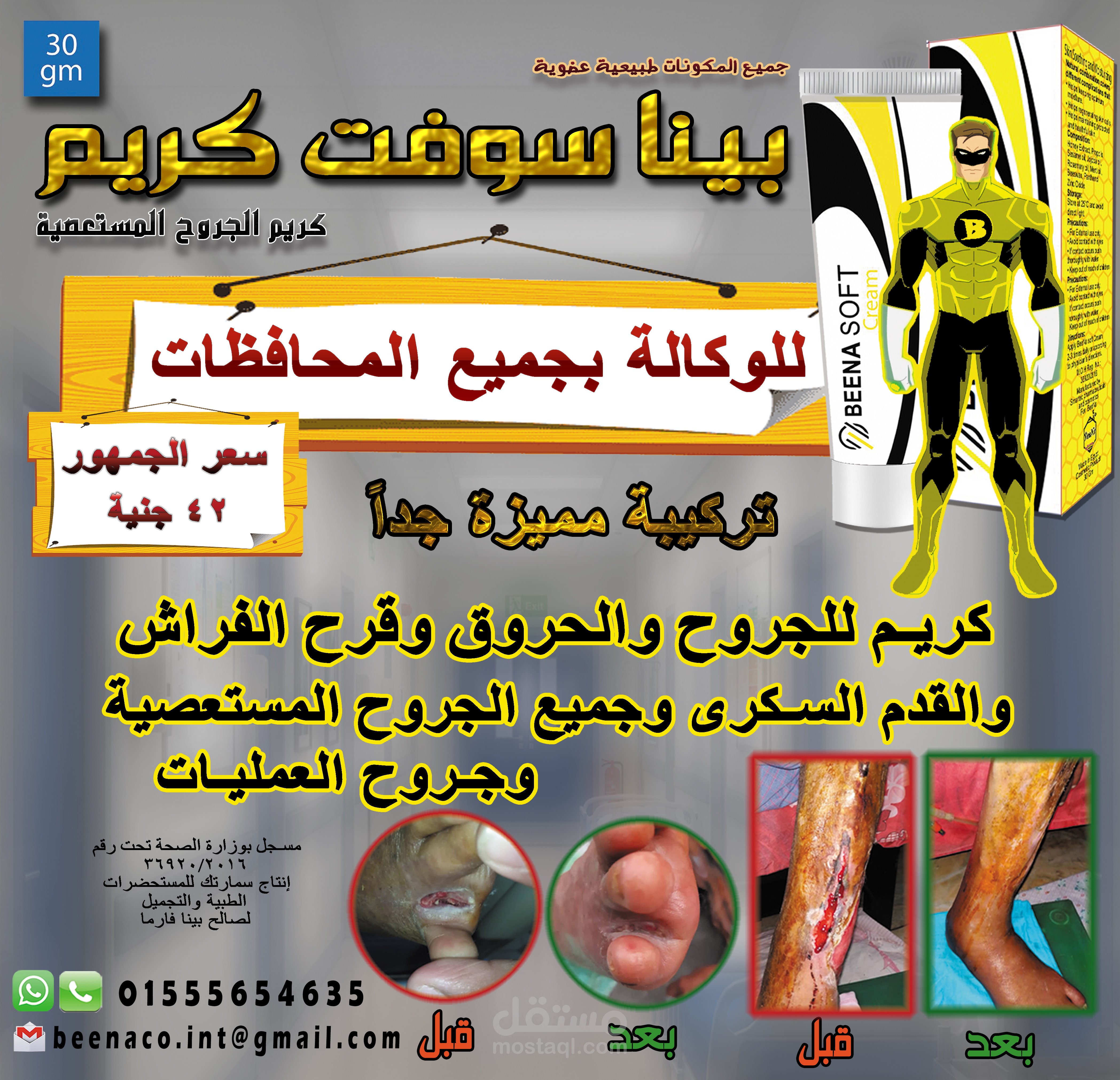 بانر كريم للحروق.