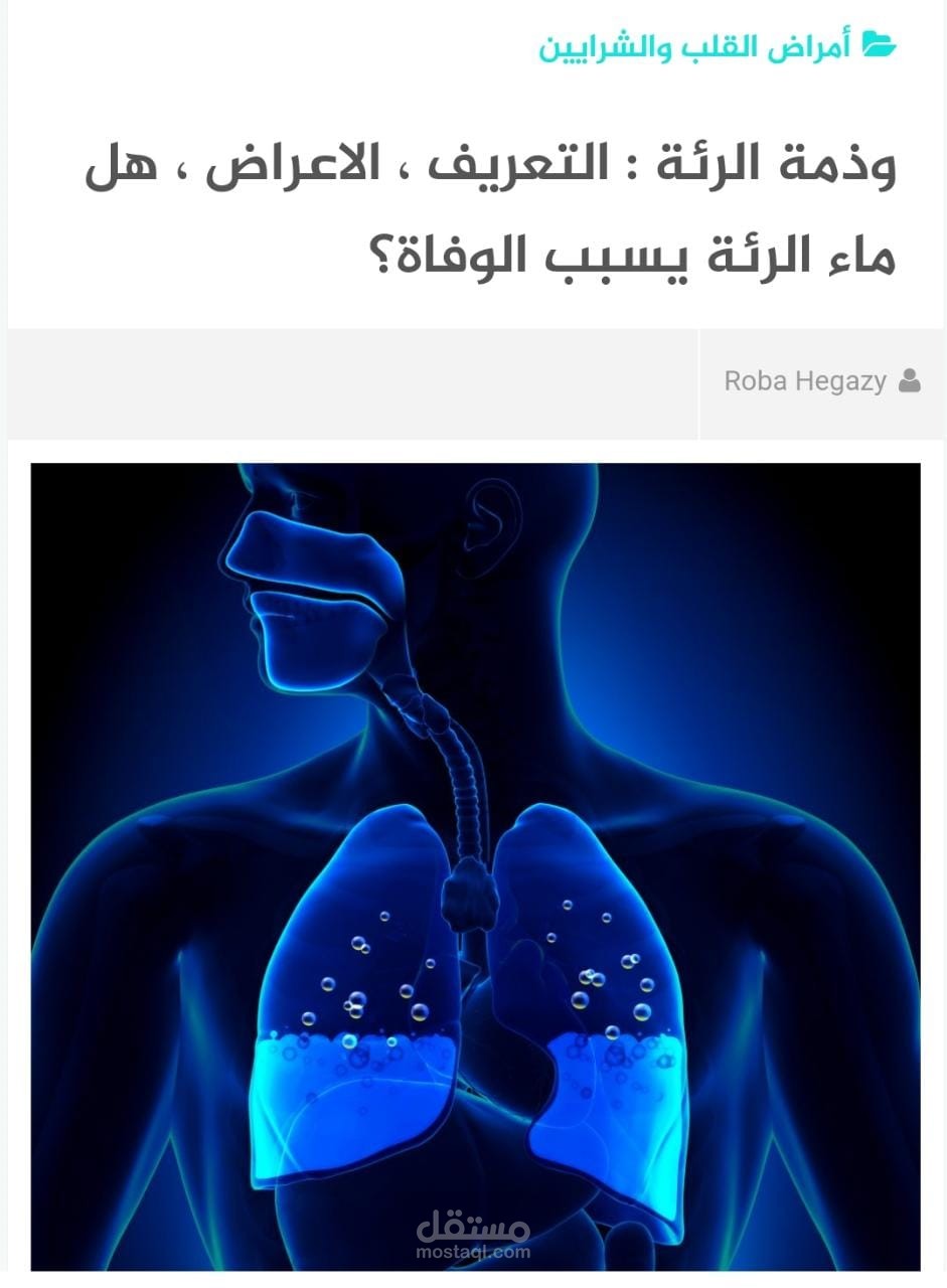 كتابة مقالات على السيو