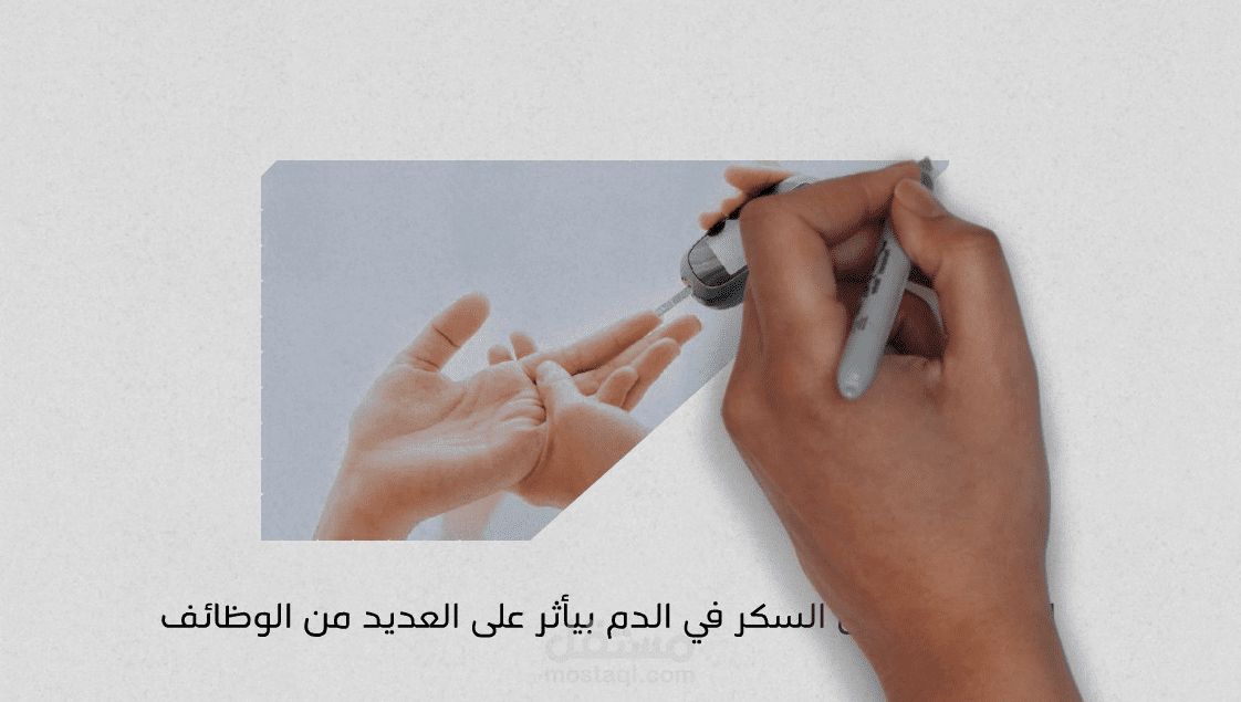 فيديو رسم (وايت بورد )  لاعلان عن جهاز اشعه لمركز اشعه طبيه