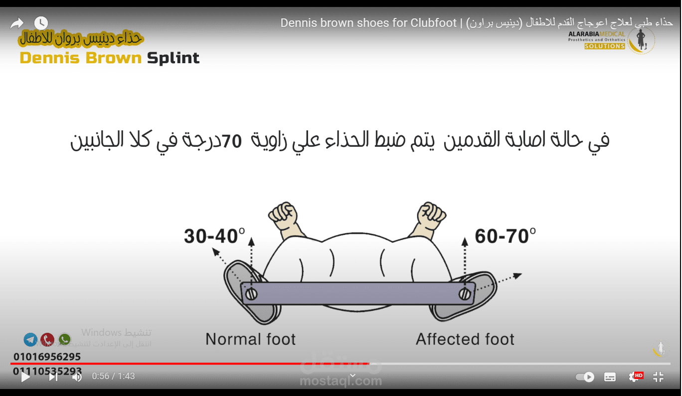 فيديو لمنتج لشركة اجهزة تعويضية