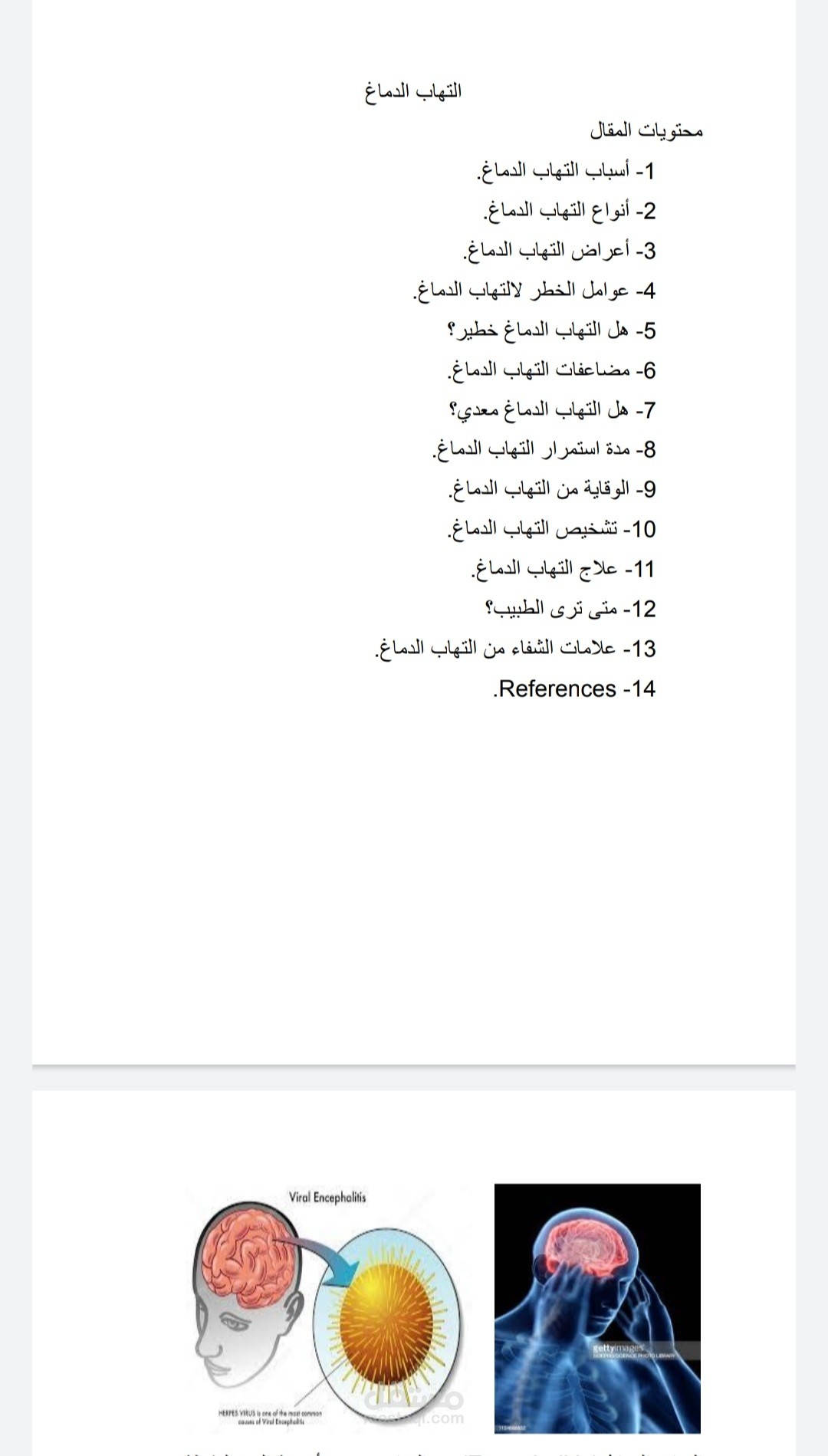 التهاب الدماغ