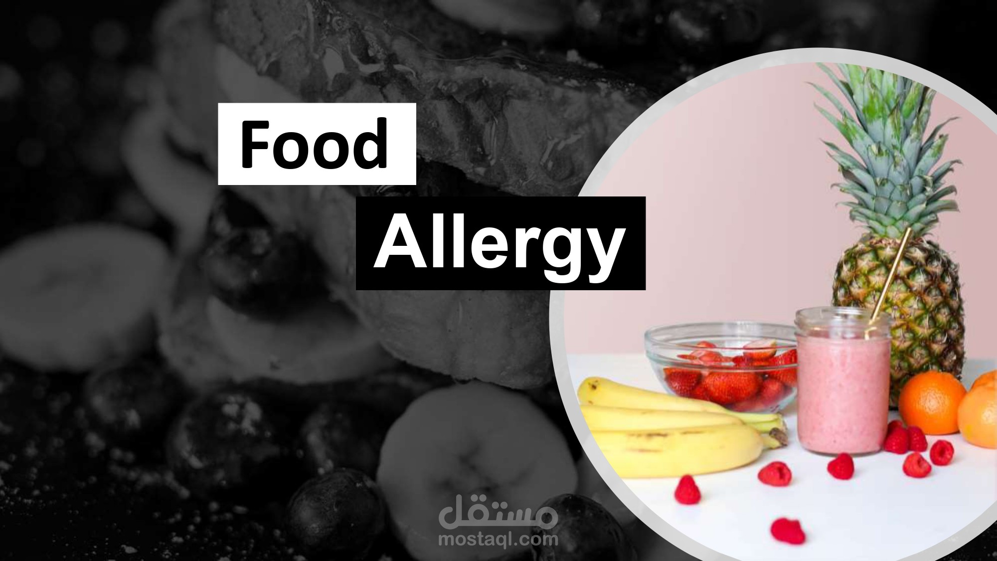 Food Allergy