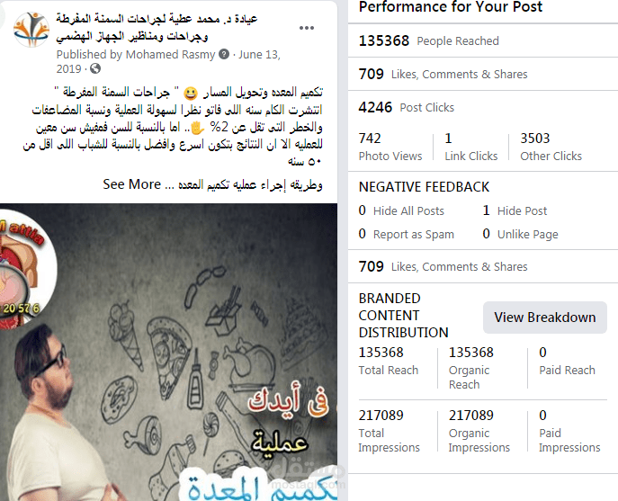 اداره حملات دكتور الجهاز الهضمى لعمليات تكميم المعده