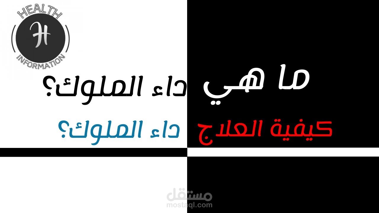 فيديو عن كل ما تحالج معرفته عن داء الملوك