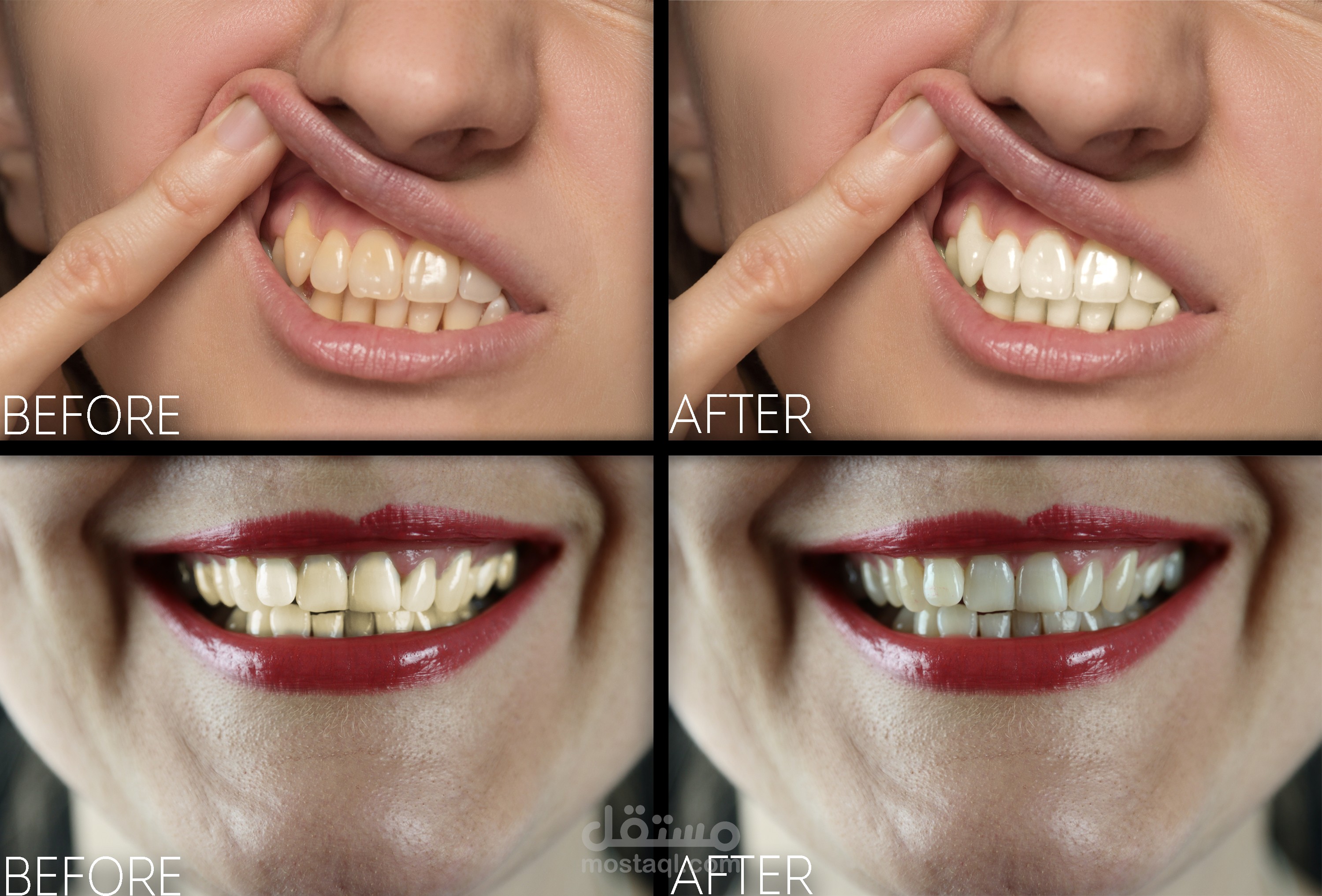 Teeth Retouching