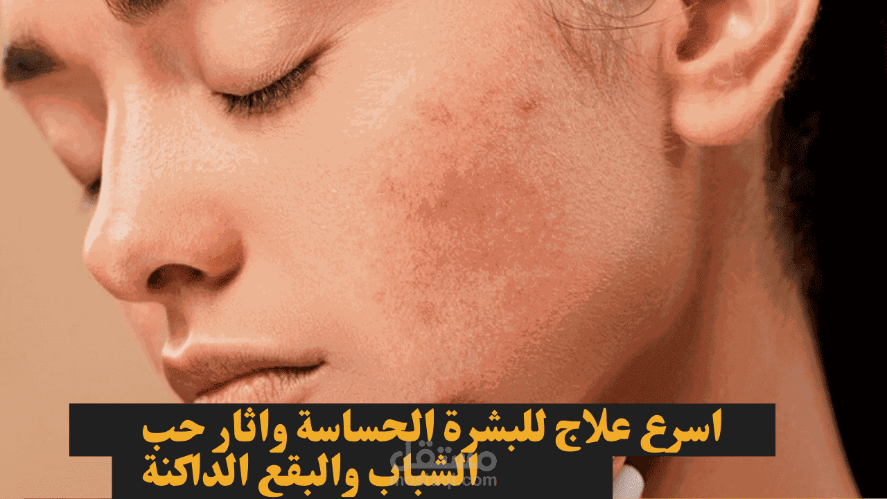 اسرع علاج للبشرة الحساسة واثار حب الشباب والبقع الداكنة