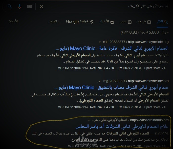 الصمام الأورطي ثنائي الشرفات