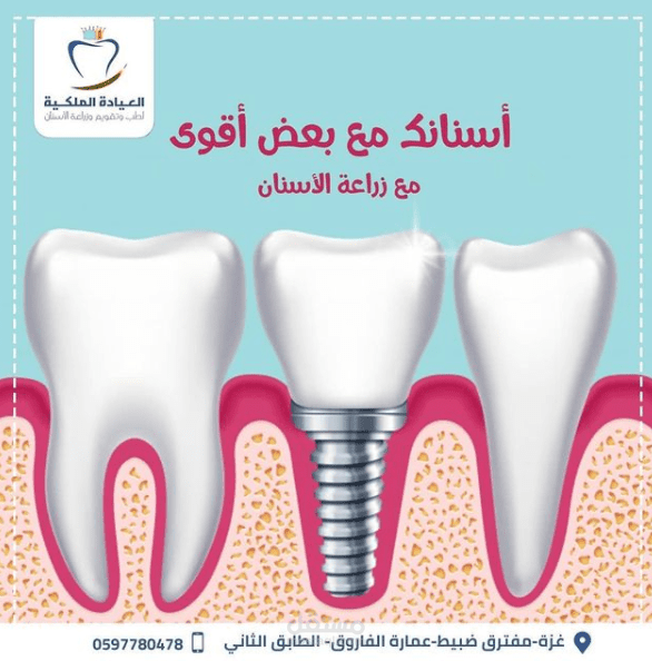 تصميم بوستات انستجرام