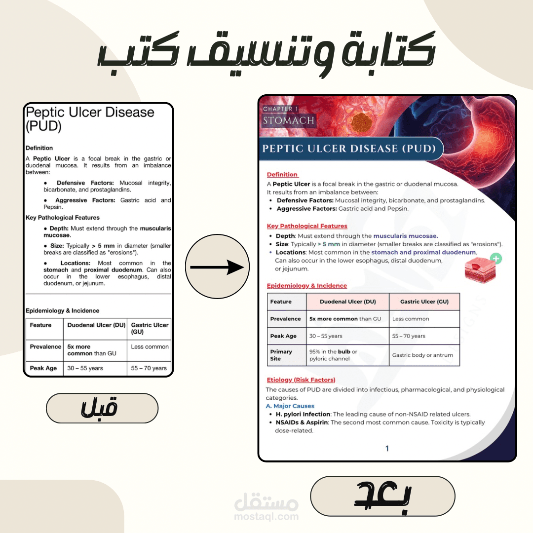 تنسيق وتلخيص احترافي: موضوع Peptic Ulcer