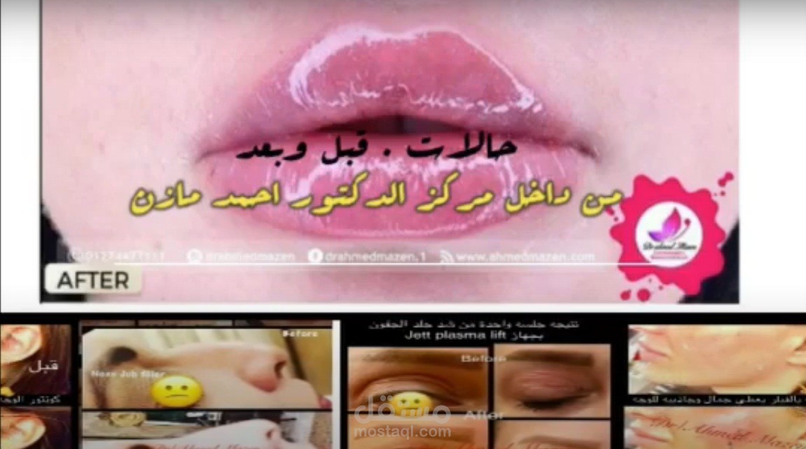 تصميم فيديو لدكتور تجميل مشهور بالوطن العربي